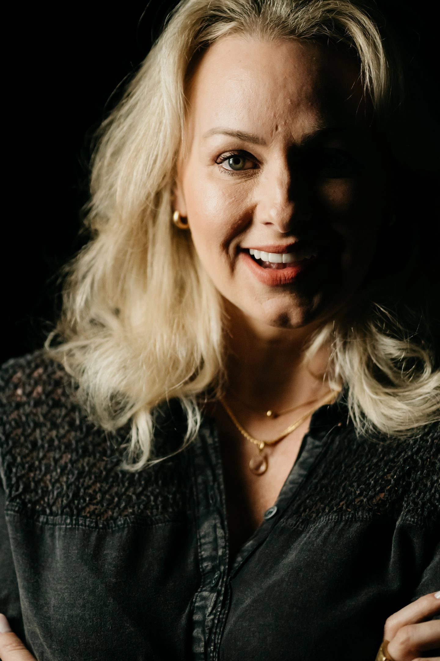 Lentes, Botox e Preenchimento